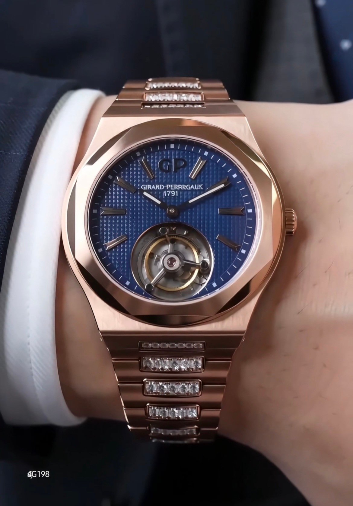 GP WATCH