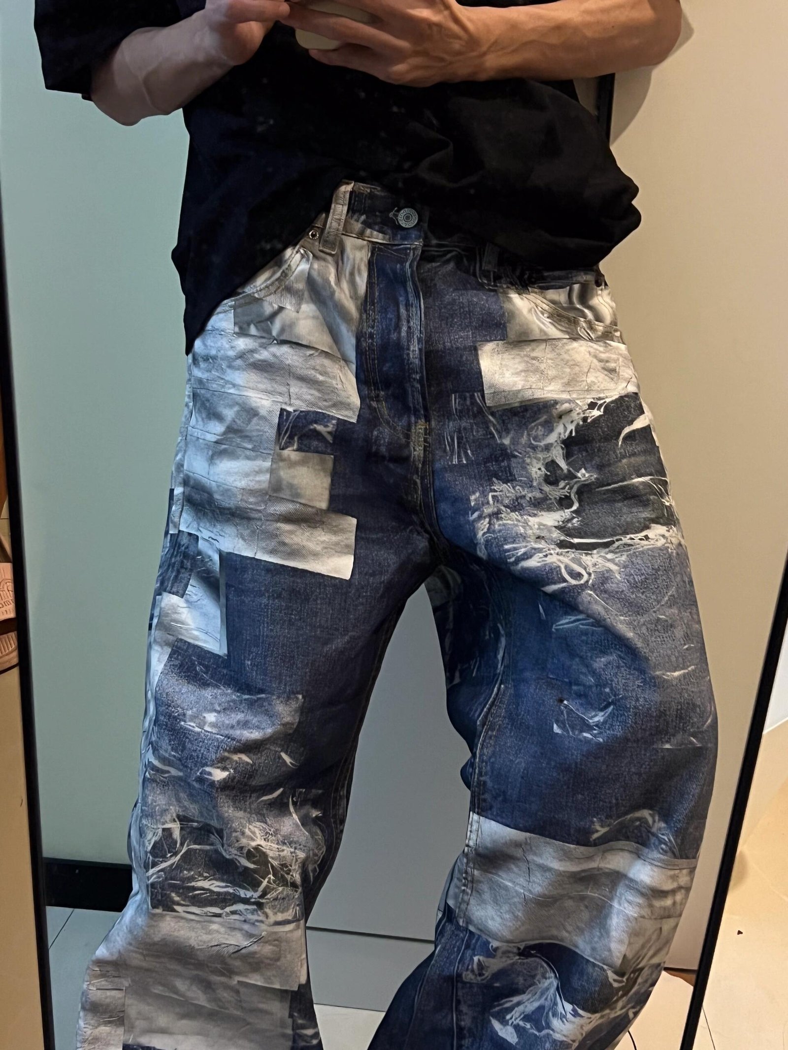 ACNE
